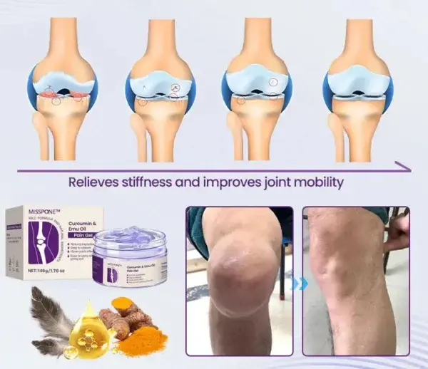 Curcumin & Emu Oil Pain Gel - Image 10