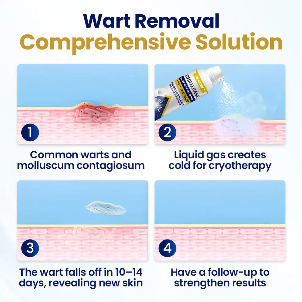 ChillErase Bump Renewal Spray - Image 6