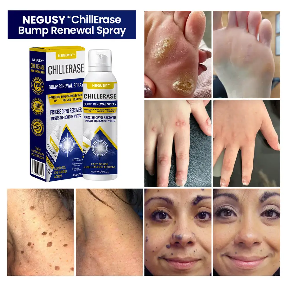 ChillErase Bump Renewal Spray - Image 8