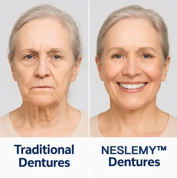 Custom-Fit Functional Dentures – Perfectly Fitted in Minutes at Home - Image 13