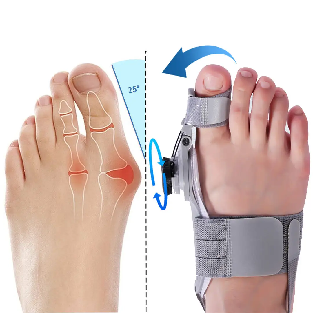 Bunion Fix - Natural At-Home Bunion Relief - Image 2