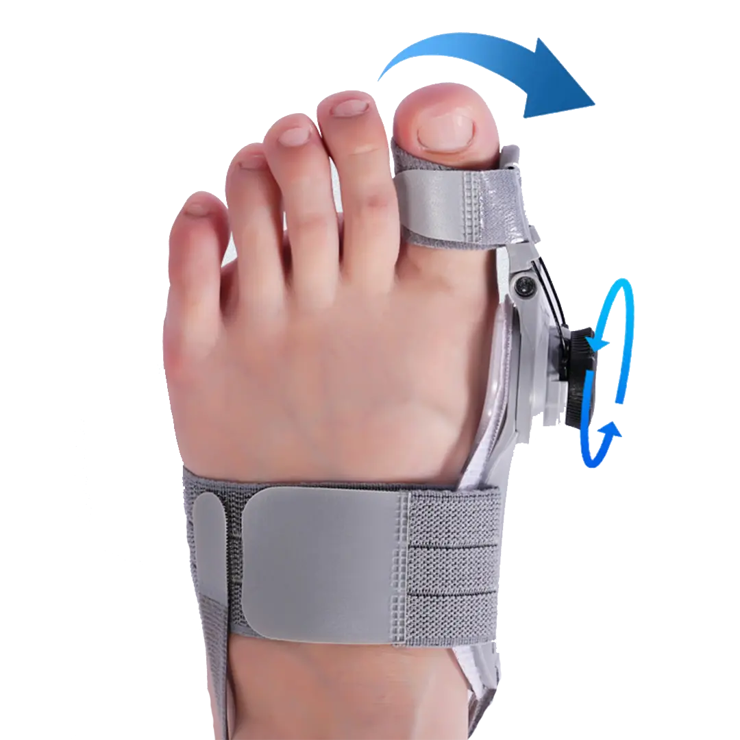 Bunion Fix - Natural At-Home Bunion Relief - Image 4