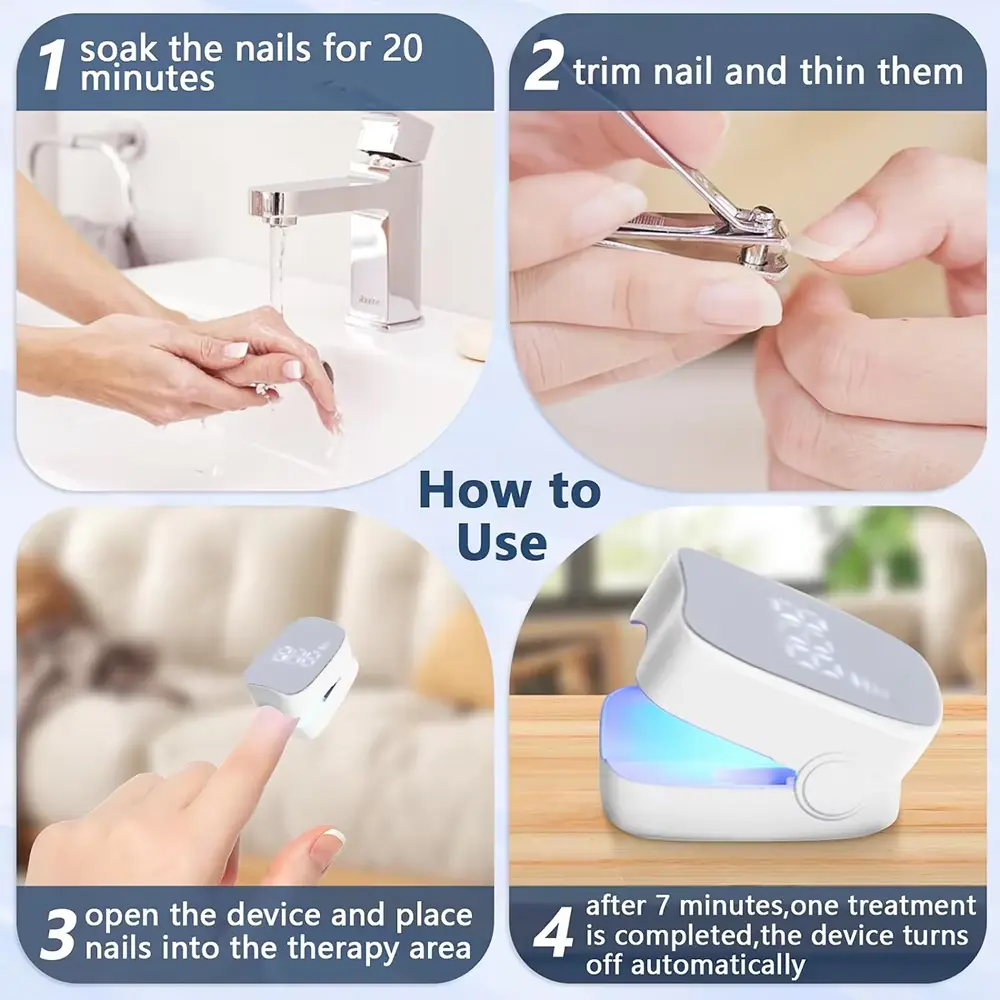 - Nail Fungus Laser Device - Image 3