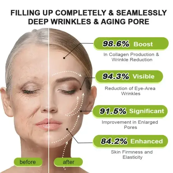 Botox & Vita-A Retinol Shot Tightening and Wrinkle-Reducing Cream - Image 4