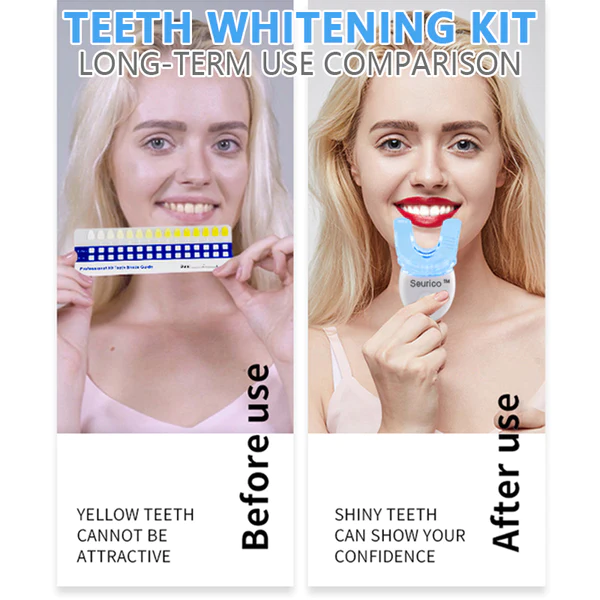 Teeth Whitening Kit with LED Light - Image 3