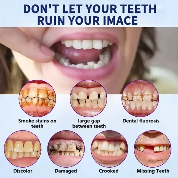 New Generation Flexible Full Denture Solution - Image 7