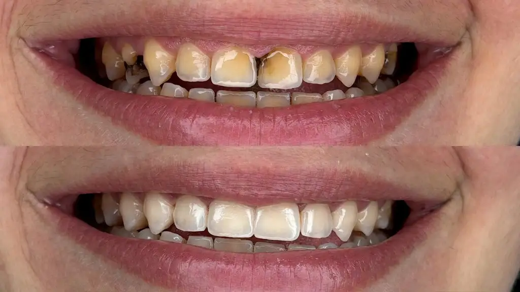 Gum Protect Repair Gel - Image 7