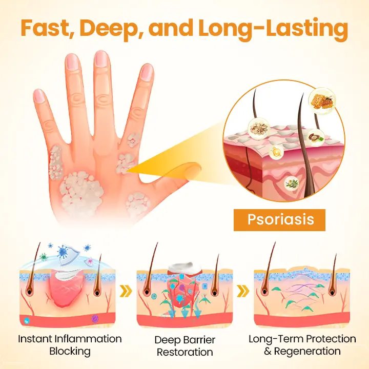 BeeLieve Psoriasis Skin Care - Image 5