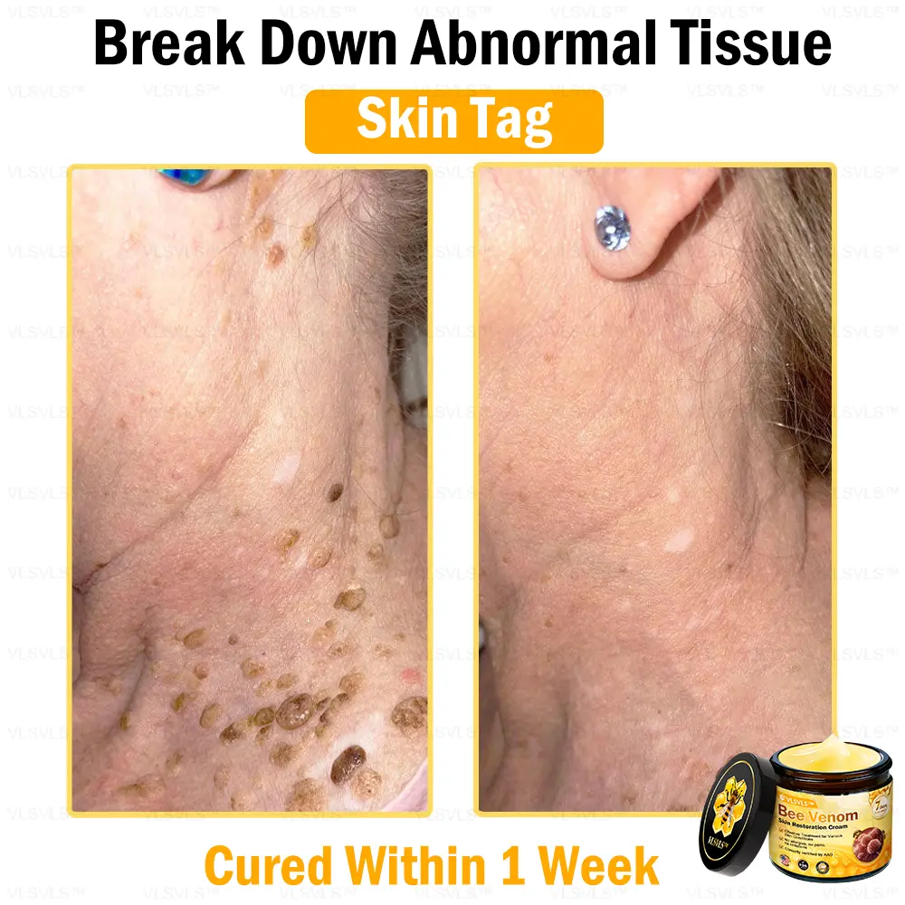 Bee Venom Skin Restoration Cream - Image 9
