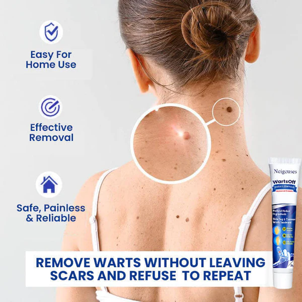 WartsOff Instant Blemish Removal Cream - Image 5