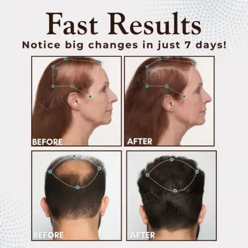 Bio-Signal Hair Regrowth Capsules - Image 2