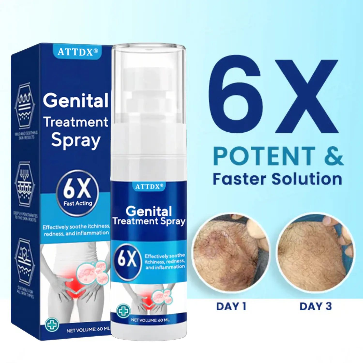 Genital Treatment Spray - Image 3