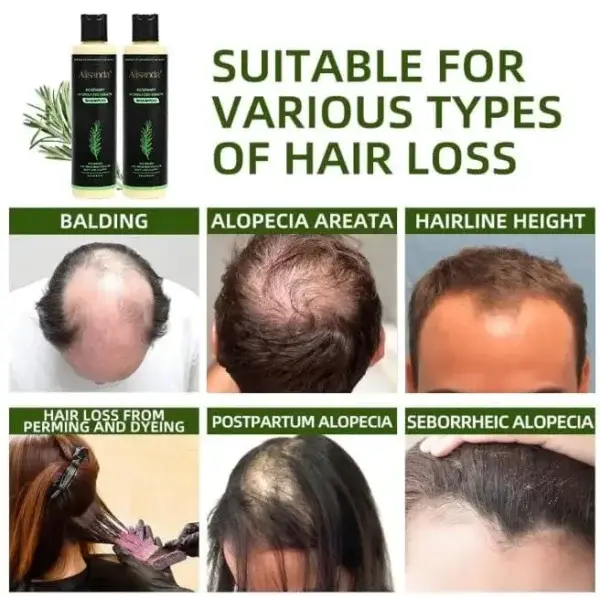 Rosemary Hydrolyzed Keratin Shampoo - Image 2