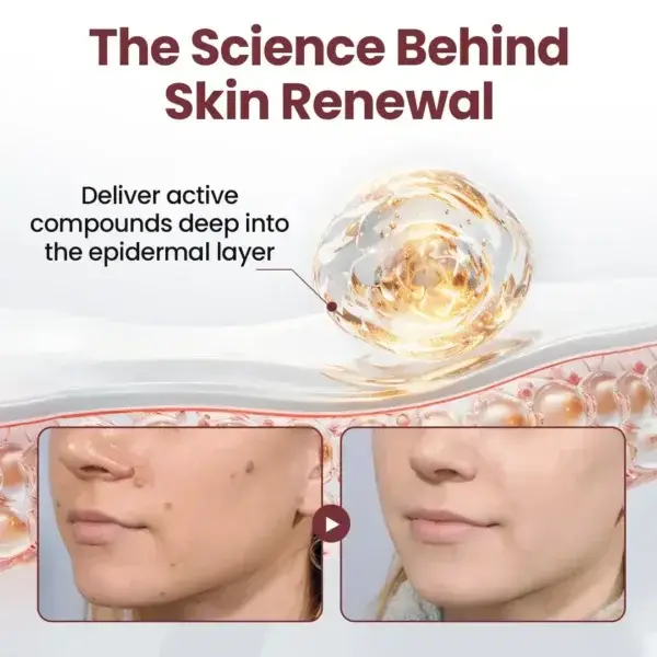 KeraErase Dual-Action Renewal Cream - Image 4