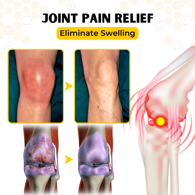 OrthoRestore Bee Venom Joint Relief Cream - Image 5