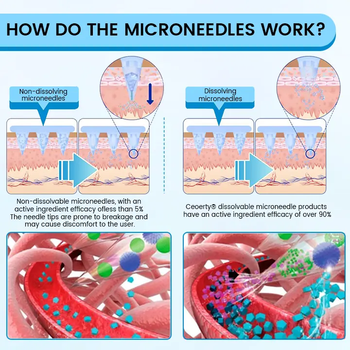 GlucaLite Nano Microneedle Patch - Image 5