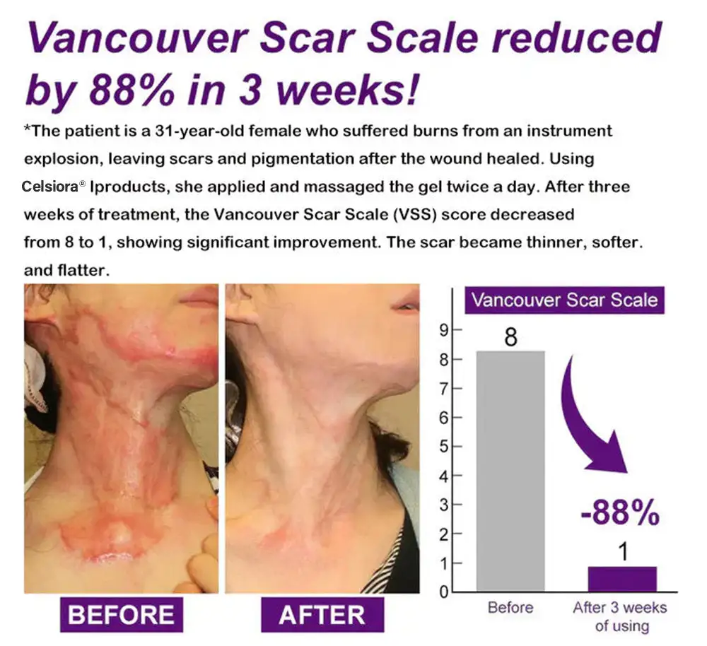 Stem Cell Scar Gel - Image 4