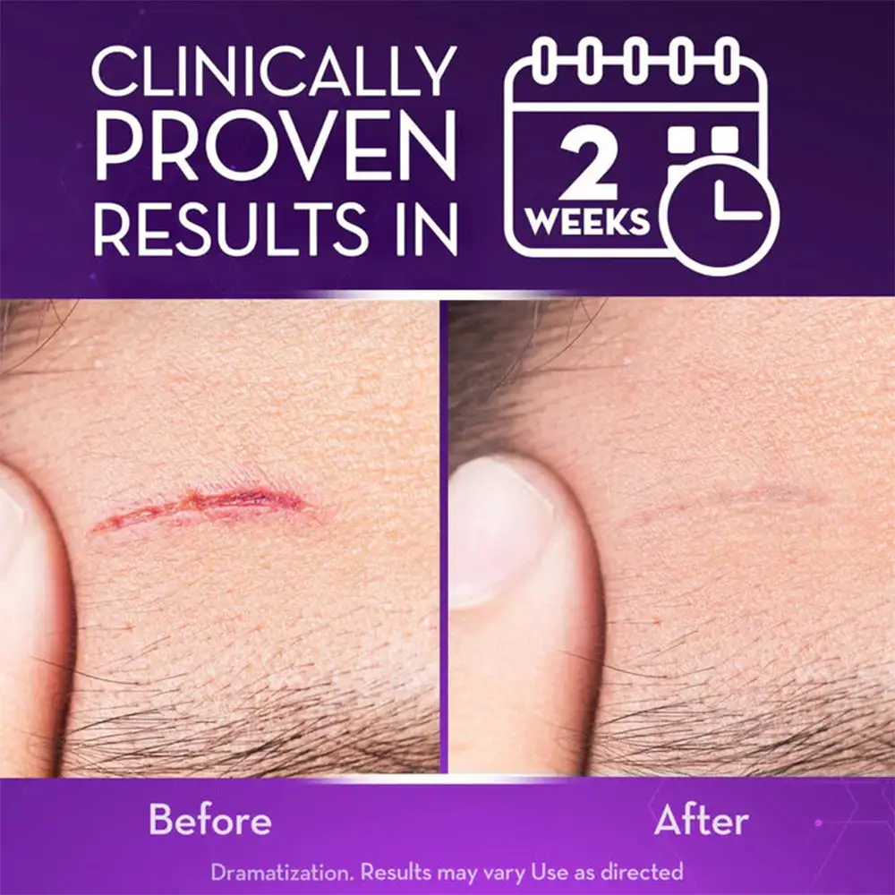 Stem Cell Scar Gel - Image 7
