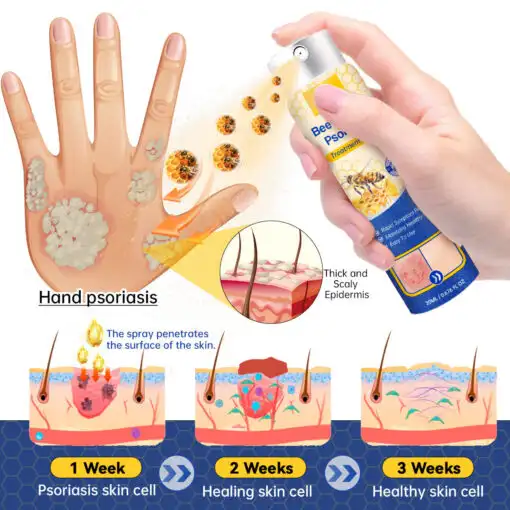PsoriaHeal Bee Venom Psoriasis Treatment Spray plus - Image 10