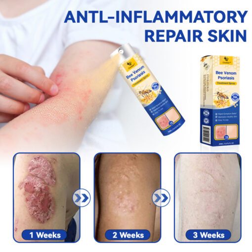 PsoriaHeal Bee Venom Psoriasis Treatment Spray plus - Image 7