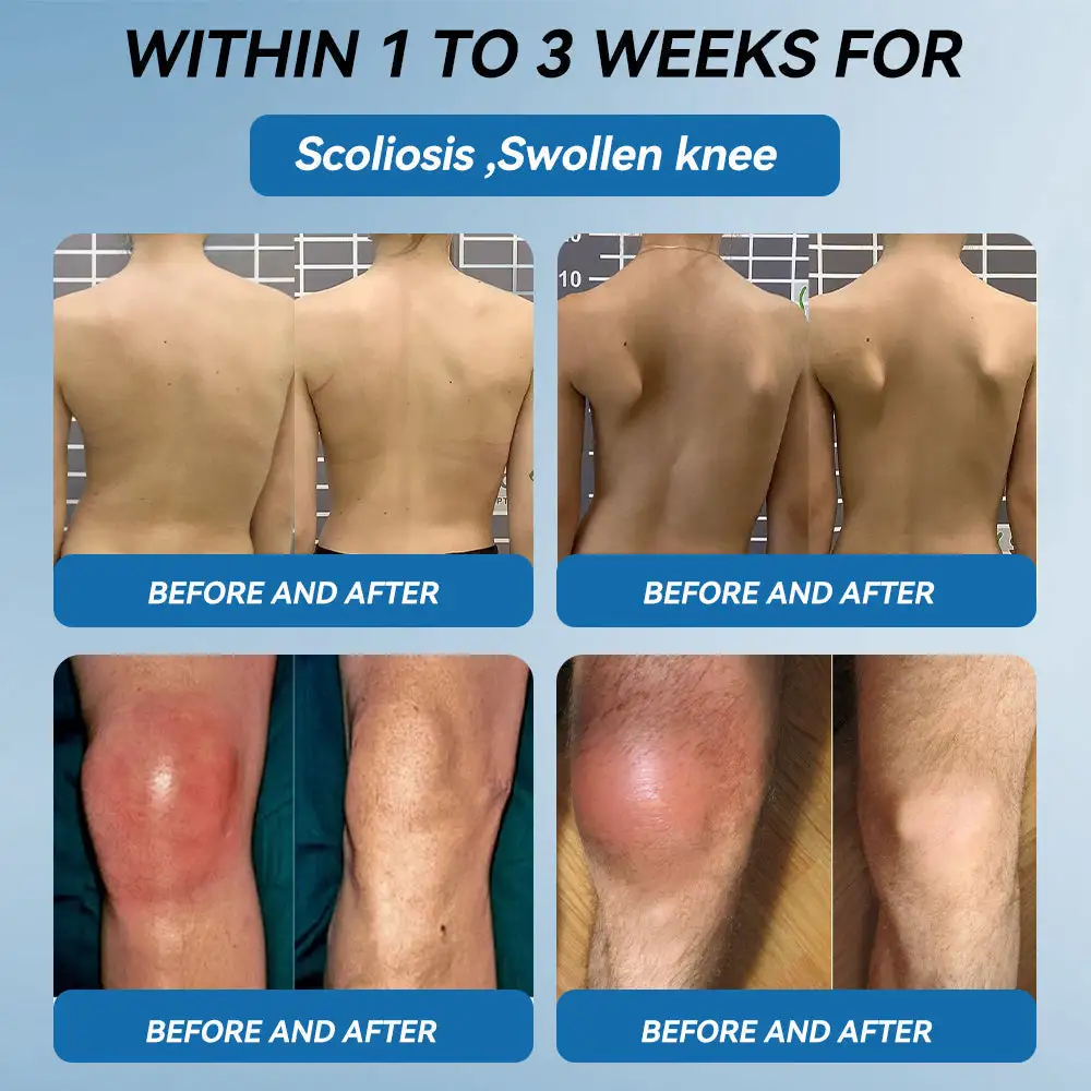 ʙ.ᴘ.ᴄ-157 Joint Healing Cream - Image 3