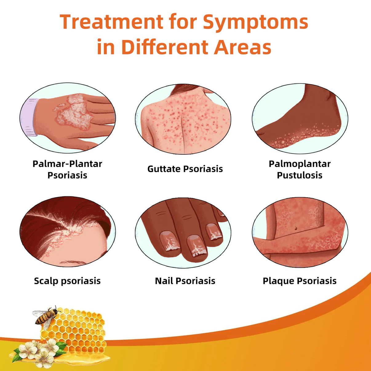 Cvreoz Bee Venom Psoriasis Treatmen - Image 3