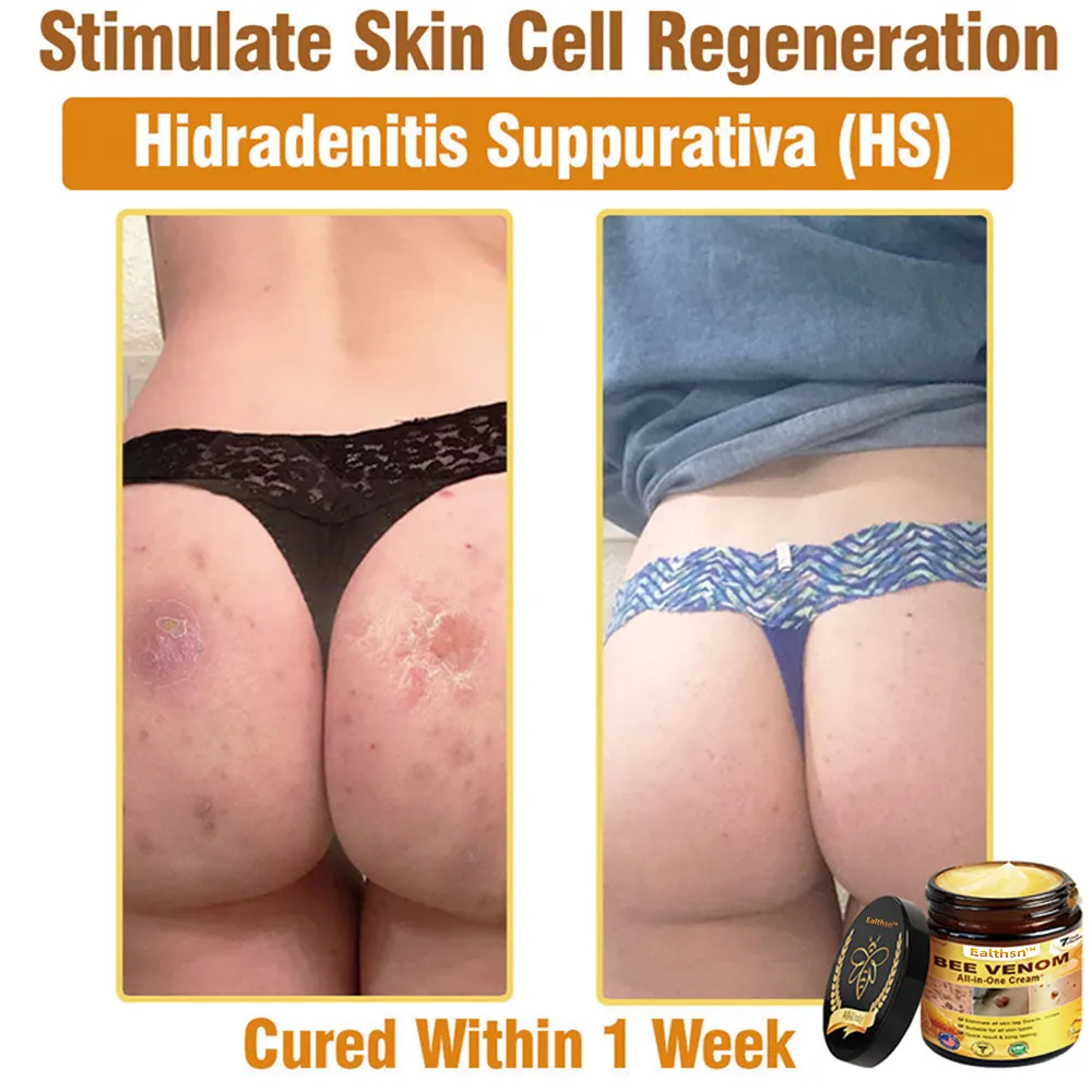 Bee Venom All-in-One Cream US Dermatologist Approved - Image 3