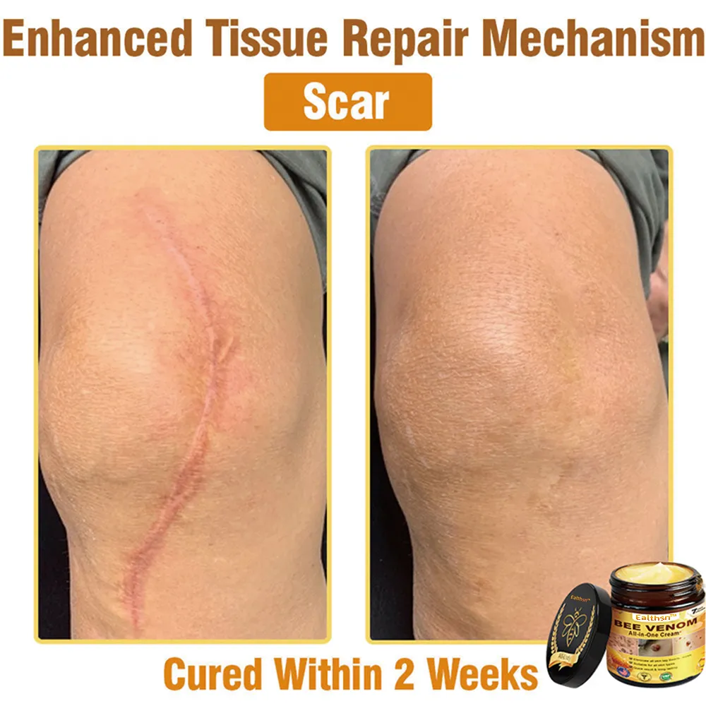 Botulinum Toxin & Bee Venom Pain-Relief Bone Healing Cream - Image 6