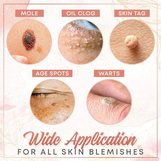 Herbal Wart Skin Removal Ointment - Image 8