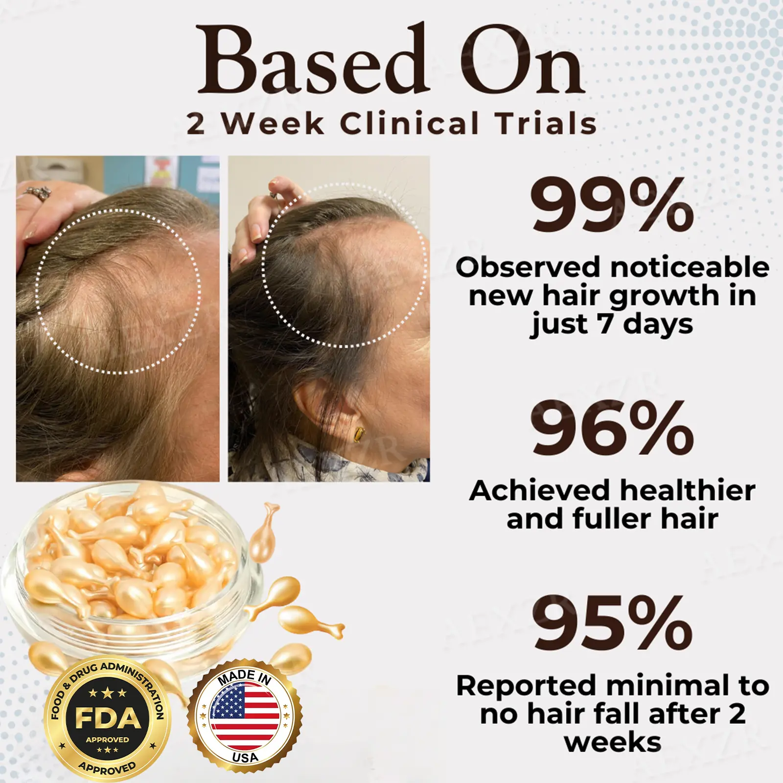 Hair Regrowth Capsules - Image 3