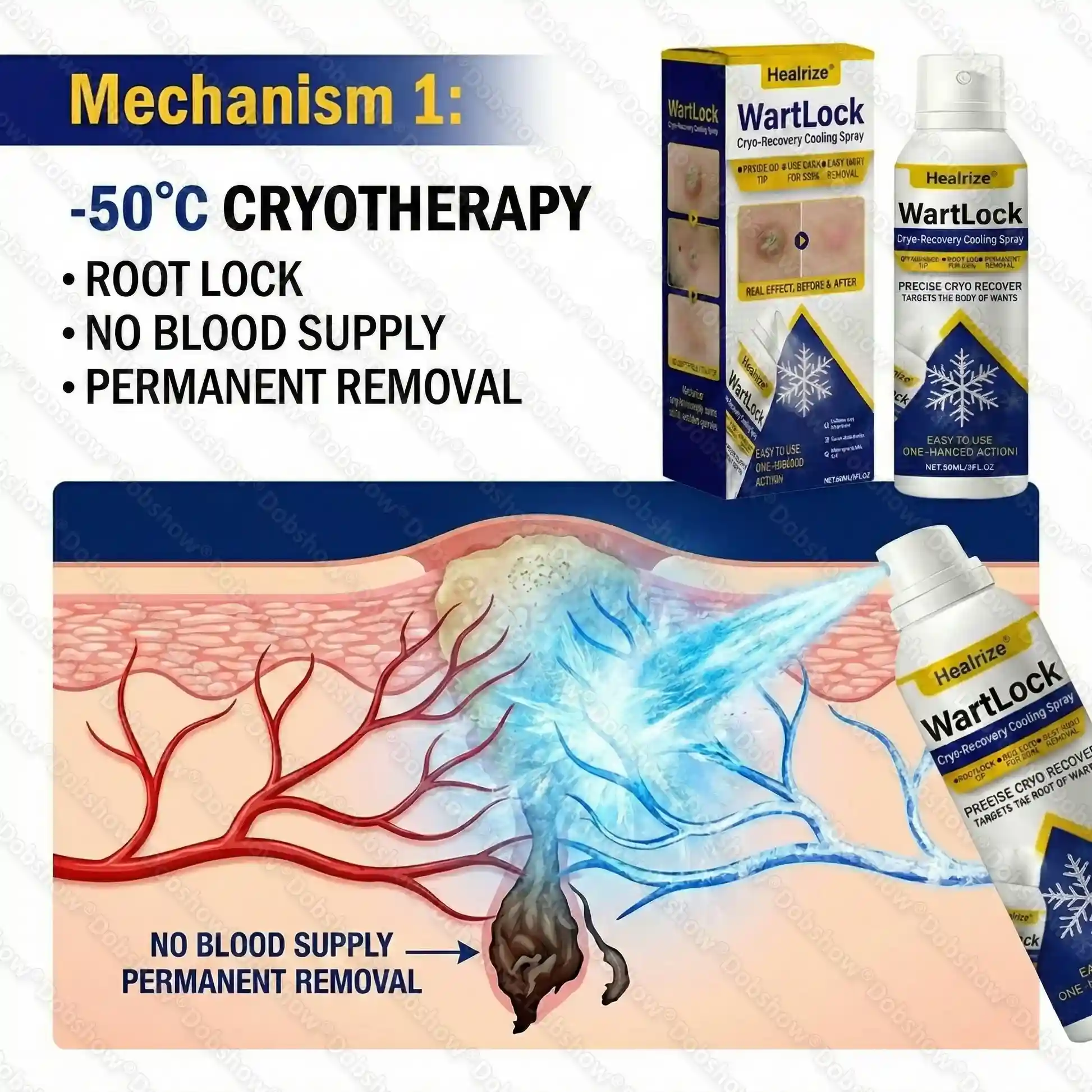 WartLock Cryo-Recovery Cooling Spray - Image 2
