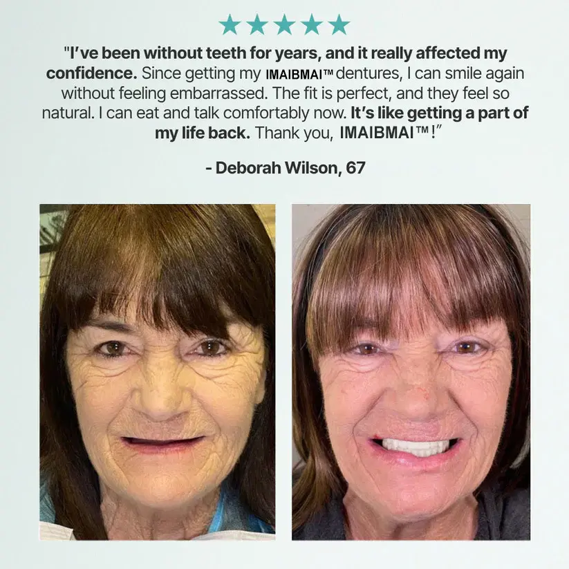 Medical Full Denture with Strong Suctiond - Image 4