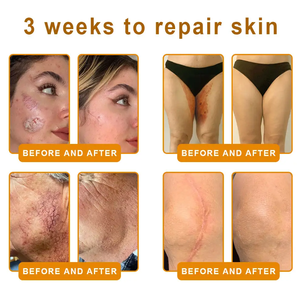 Bee Venom Skin Restoration Cream - Image 13