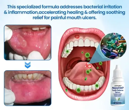 NanoHAP Tooth Defense Serum - Image 13