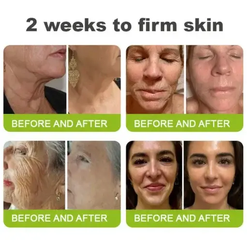 Skin Tightening Vita-A Retinol Retinol shot Anti-Wrinkle Firming Tightening cream – Last Day Promotion 70 OFF - Image 7