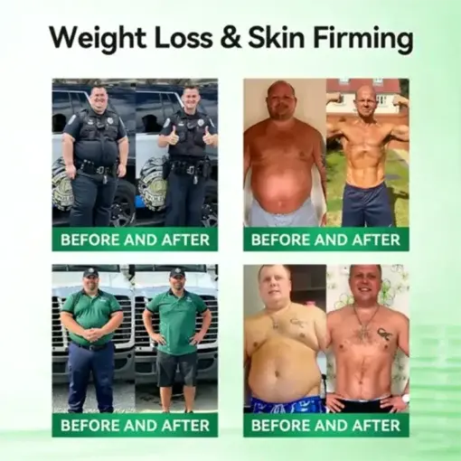 10-IN-1,Moringa-Slimming and Fat-Burning Hot Cream (Once Daily, visiblechanges in 7 days)Obesity, Diabetes, SleepApnea, And Joint Issues - Image 2