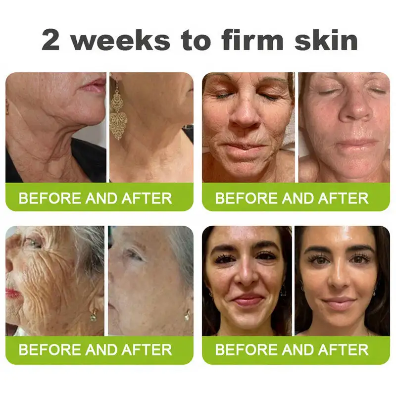 Skin Tightening & Vita-A Retinol Retinol shot Anti-Wrinkle Firming Tightening cream - Last Day Promotion 70% OFF - Image 7