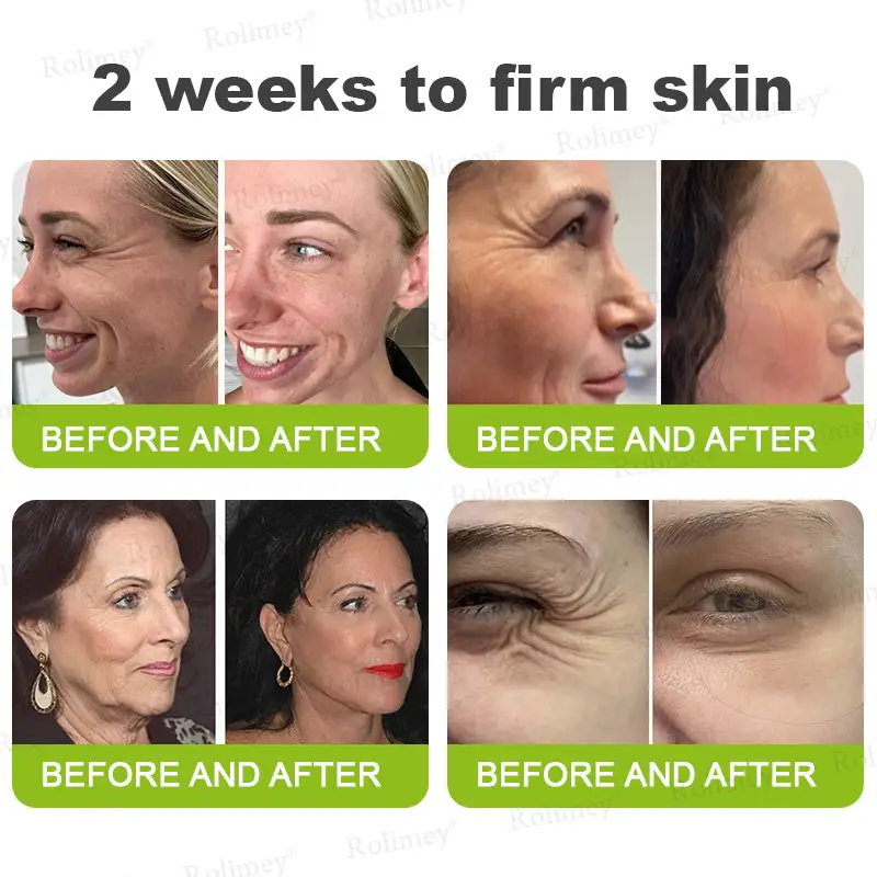Botox & Vita-A Retinol Shot Wrinkle-Lift Tightening Cream - Image 6