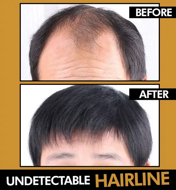 Men's Hair Topper - Image 2