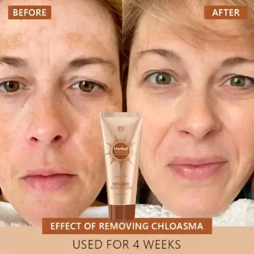 Whitening and Spot-Removing Face Mask Suitable for face and body - Image 2
