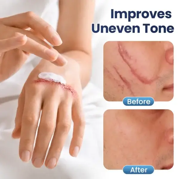 DERMALUX Texture Repair Gel - Image 3