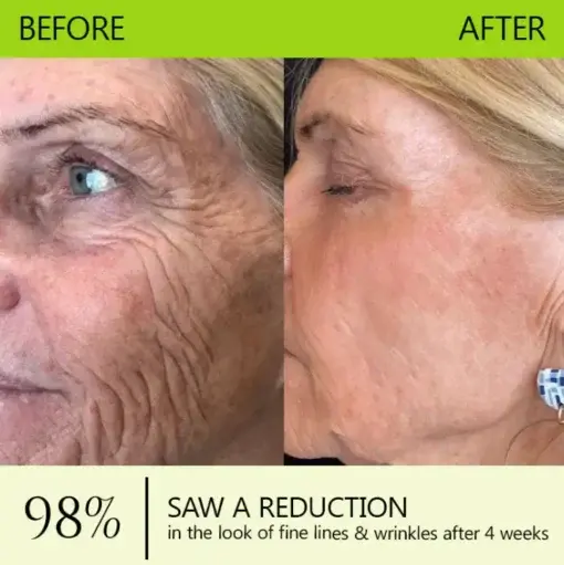 Botox Retinol Shot , FDA-Compliant Formula to Firm Sagging Skin Reduce Puffy Eyes - Image 3