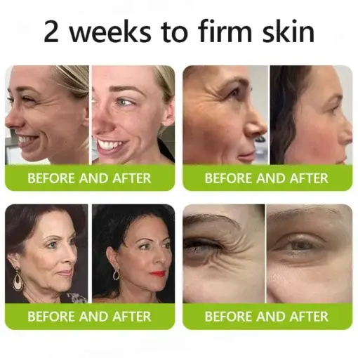 Botox Retinol Shot , FDA-Compliant Formula to Firm Sagging Skin Reduce Puffy Eyes - Image 5