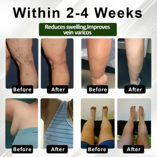 Leg Therapy Edema Cream Trust - Image 3