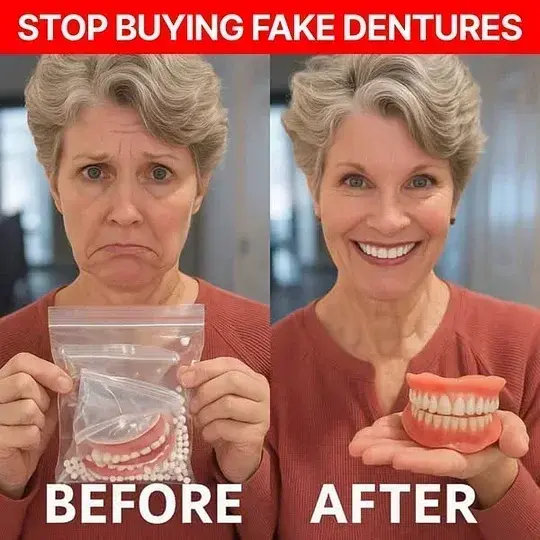 Premium Full Dentures - Image 2