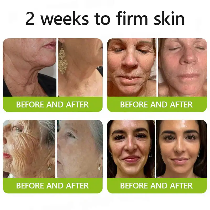 BOTOX & VITA A RETINOL SHOT Wrinkle Lift Tightening Cream - Image 10
