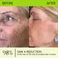 BOTOX & VITA A RETINOL SHOT Wrinkle Lift Tightening Cream - Image 33