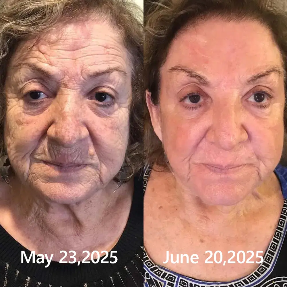 BOTOX & VITA A RETINOL SHOT Wrinkle Lift Tightening Cream - Image 41