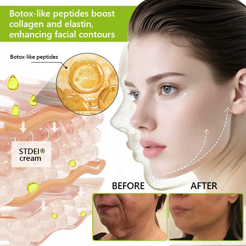 BOTOX & VITA A RETINOL SHOT Wrinkle Lift Tightening Cream - Image 46