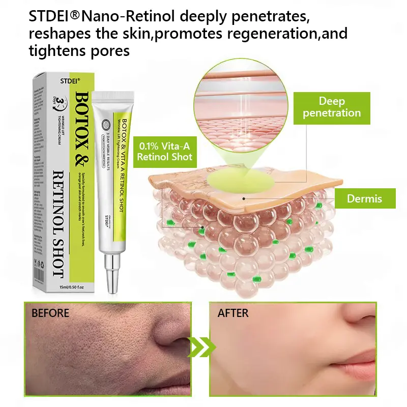 BOTOX & VITA A RETINOL SHOT Wrinkle Lift Tightening Cream - Image 47